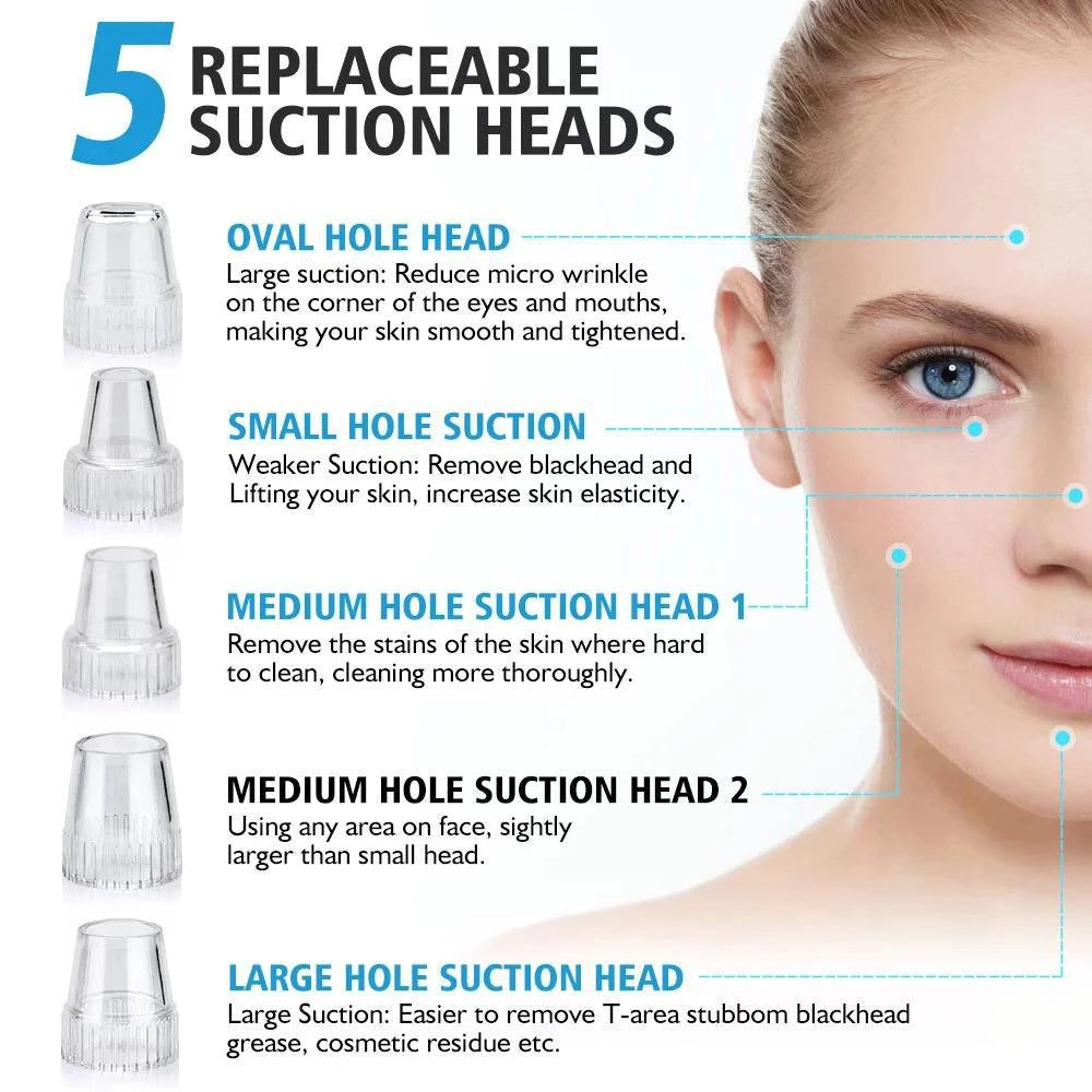 Electric Blackhead Pore Vacuum Remover – 5-Level Suction, USB Rechargeable