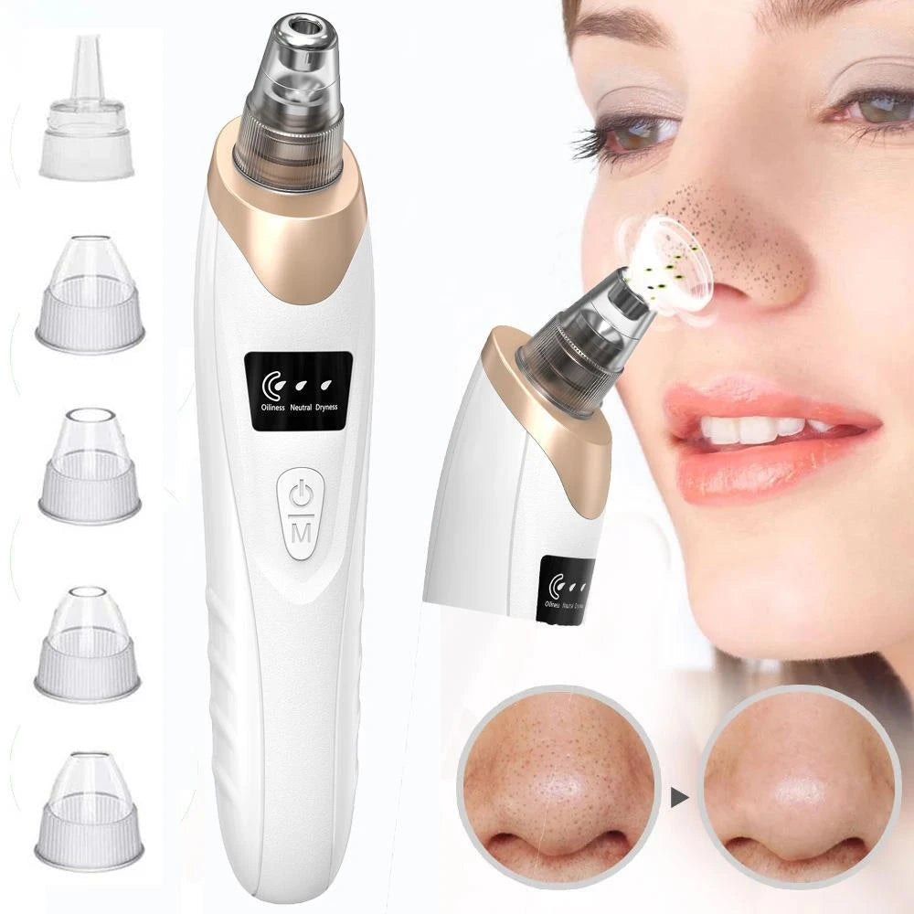 Electric Blackhead Pore Vacuum Remover – 5-Level Suction, USB Rechargeable