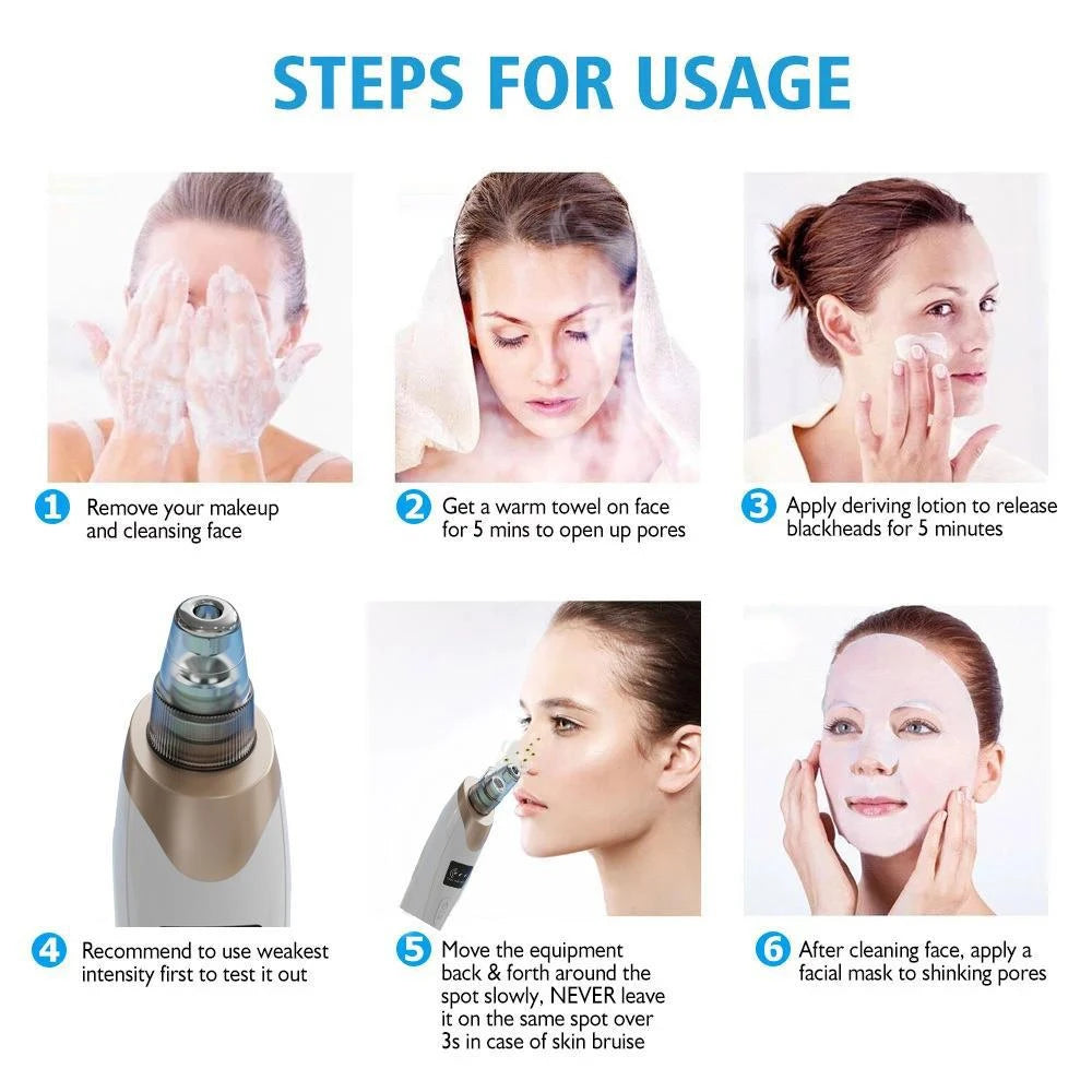 Electric Blackhead Pore Vacuum Remover – 5-Level Suction, USB Rechargeable